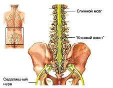 Сколиоз Сколиоз